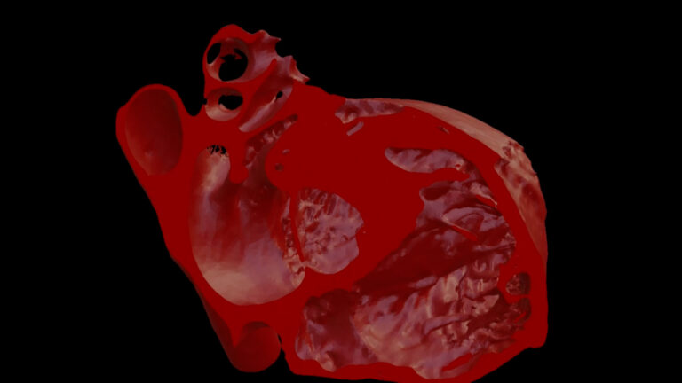 OSF Innovation Brings Beating Hearts to Life in VR for Safer Surgeries